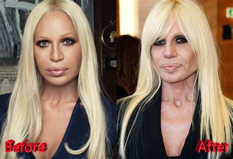 in che anno e nata donatella versace|donatella versace before and after surgery.